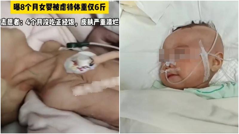 廣州一名8個月大的女嬰體重只有3.5公斤。（示意圖／翻攝Unsplash）