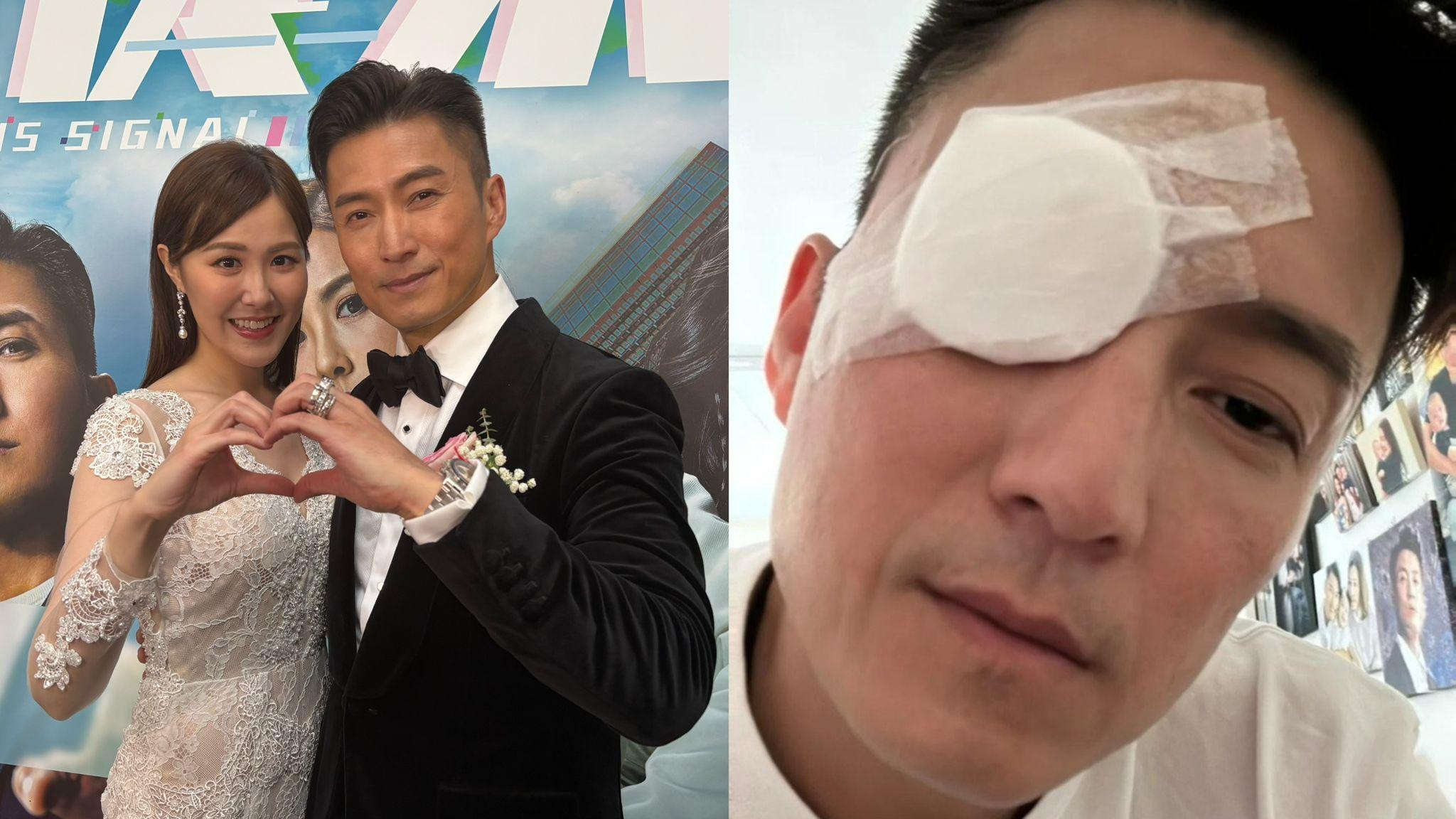 陳山聰指眼睛嚴重發炎已經康復：去醫務所做咗個小手術