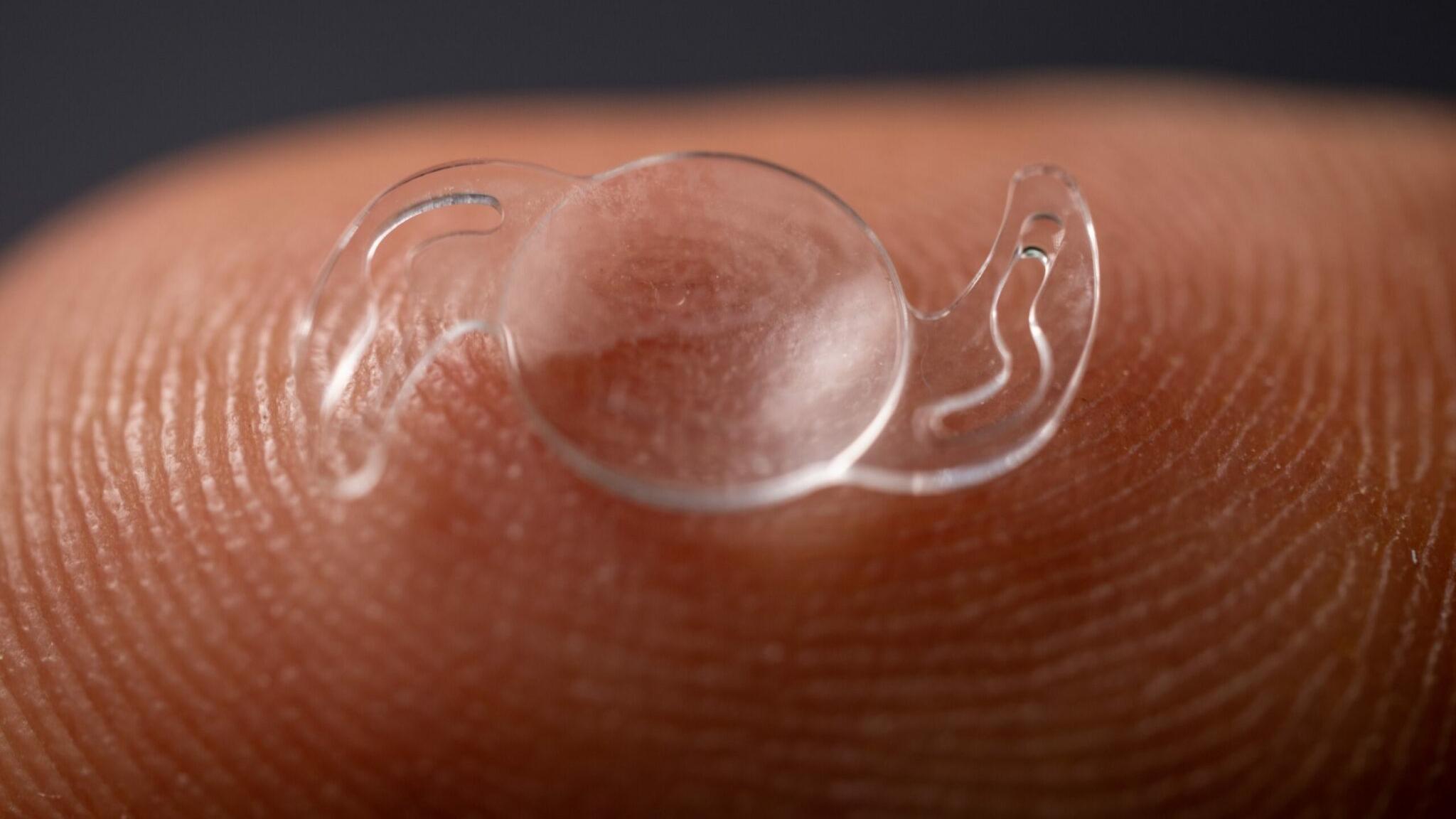 新一代長焦段人工晶體以純折射式設計取代傳統水晶體的繞射圈設計，大幅減少患者術後光暈眩光比例。