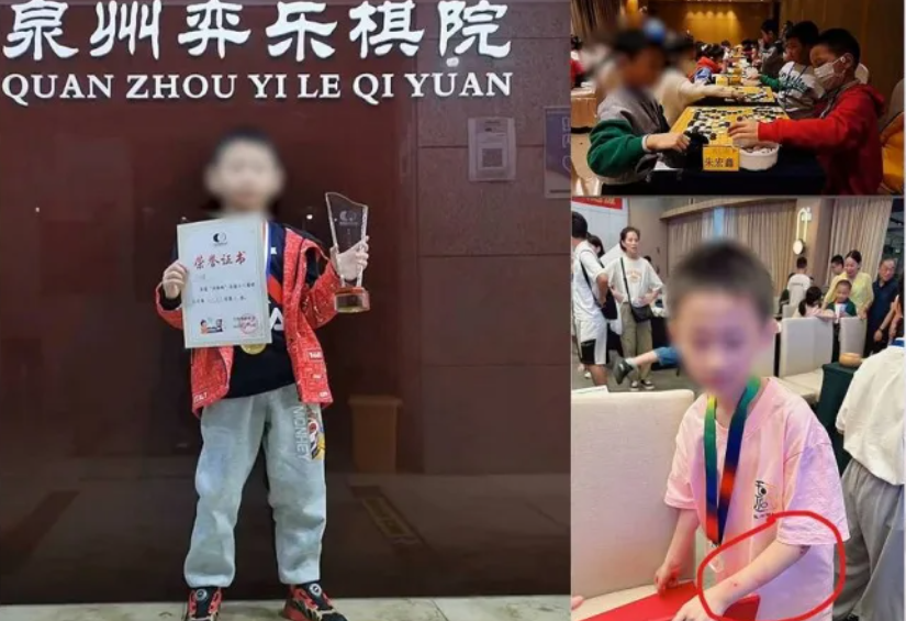 內媒引消息稱，朱宏鑫的單親父親嚴苛催谷其棋藝長期虐打，手臂上有明顯傷痕，近日賽事失利後更遭父親當眾「穿心腿」，網民稱長期家暴或為悲劇誘因。(網上圖片)