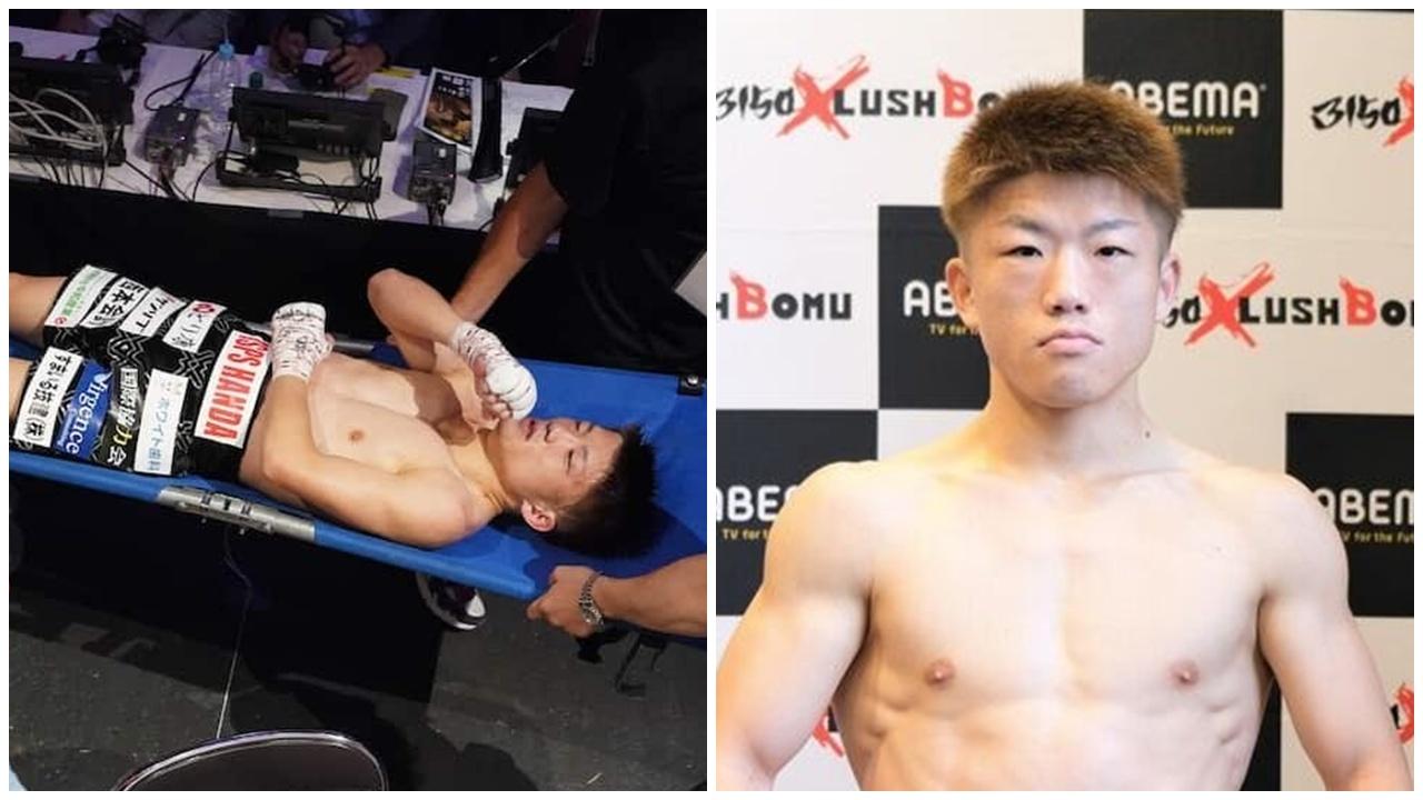 前世界拳王擂台昏迷緊急開顱，被強制退役。(X)