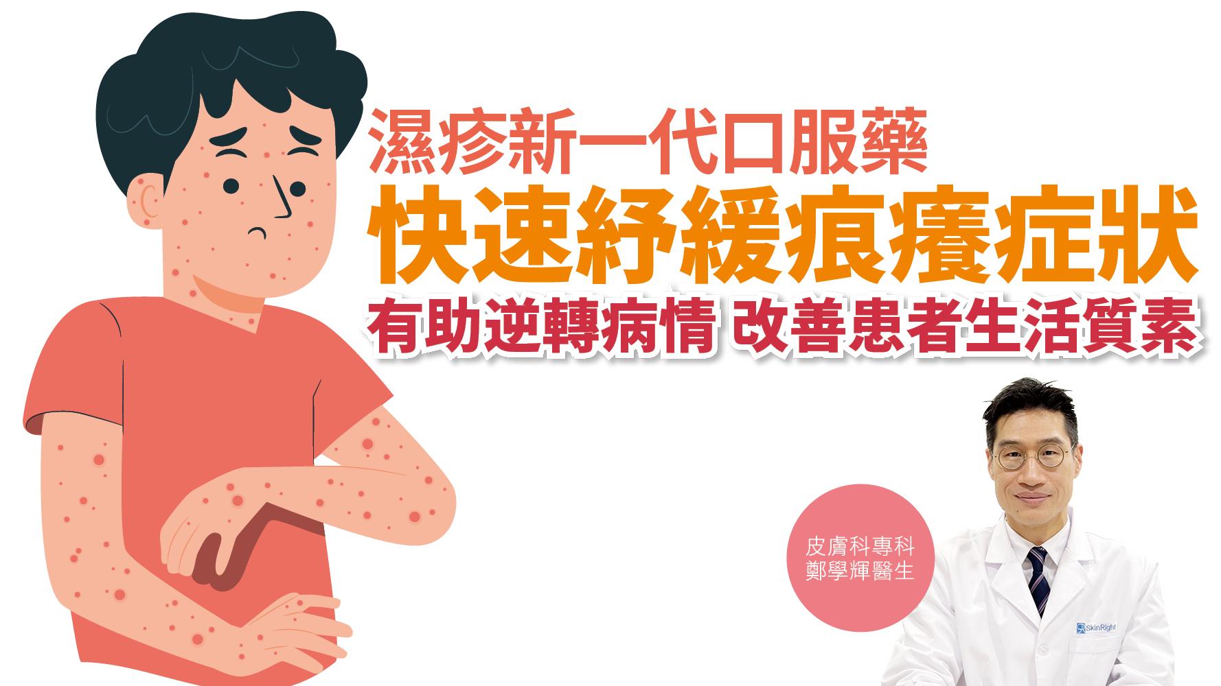 健康解碼｜濕疹新一代口服藥 快速紓緩痕癢症狀 有助逆轉病情 改善患者生活質素 