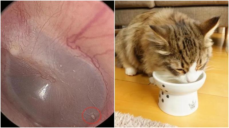 湖北男耳鳴以為過勞　一查發現耳膜有貓蟎蟲寄居