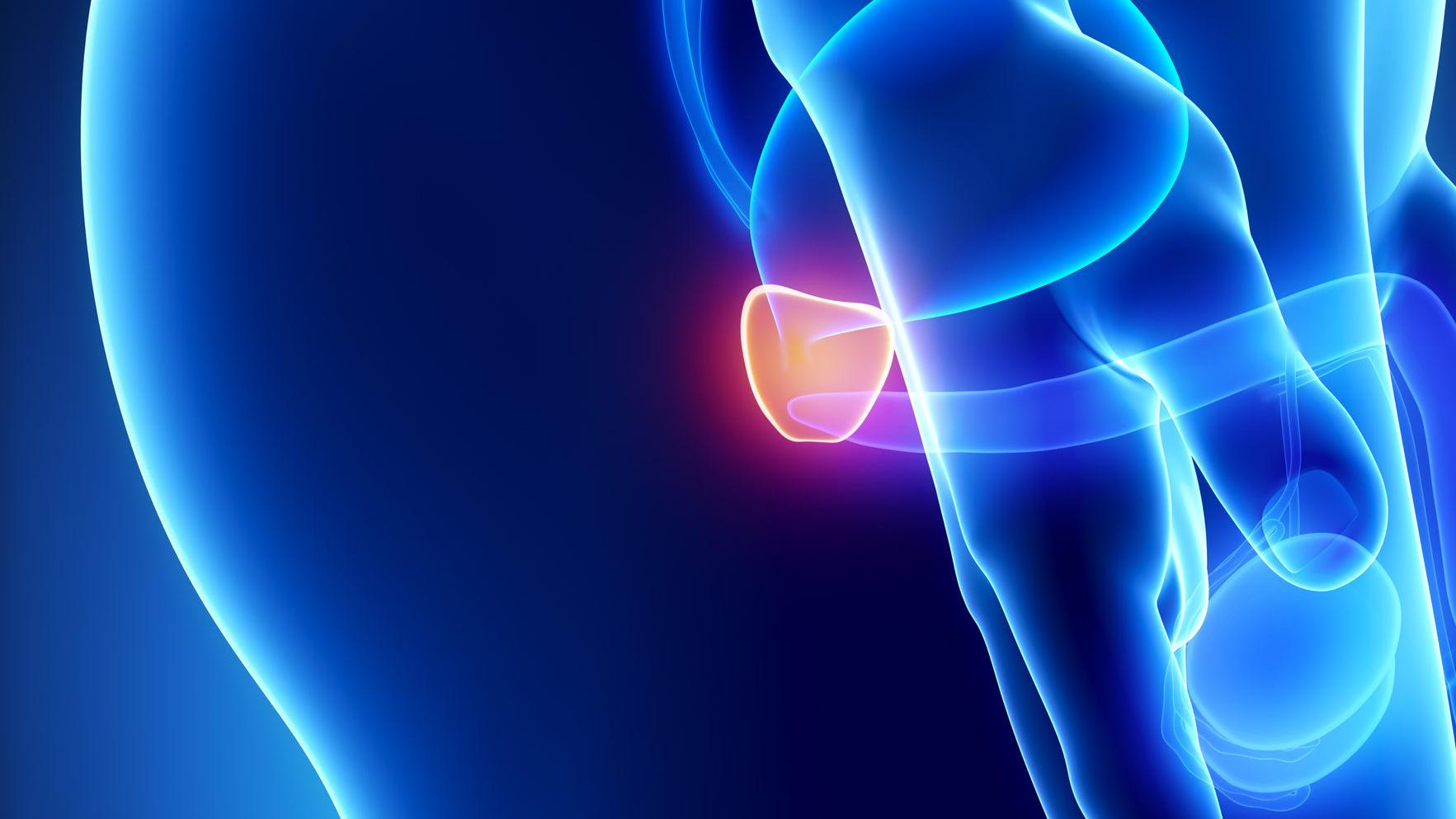 保健食品對治療慢性前列腺炎有幫助嗎