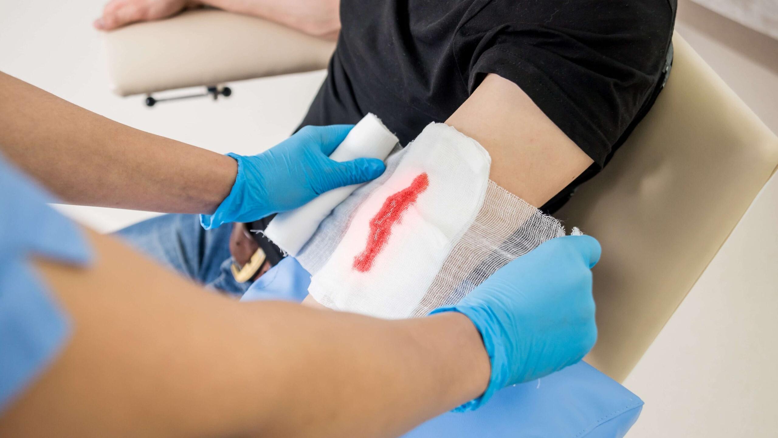 使用生理食鹽水沖洗、清潔是傷口照護的第一步，劉恩瑋醫生提到，不論是哪一種傷口，首重就是要把傷口分泌出來的組織液、血、膿等徹底清除。