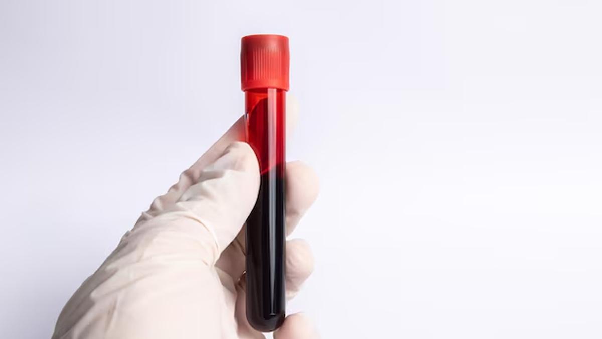 加勒比海小島婦人驗出新血型，全球僅此一人。(資料圖片)