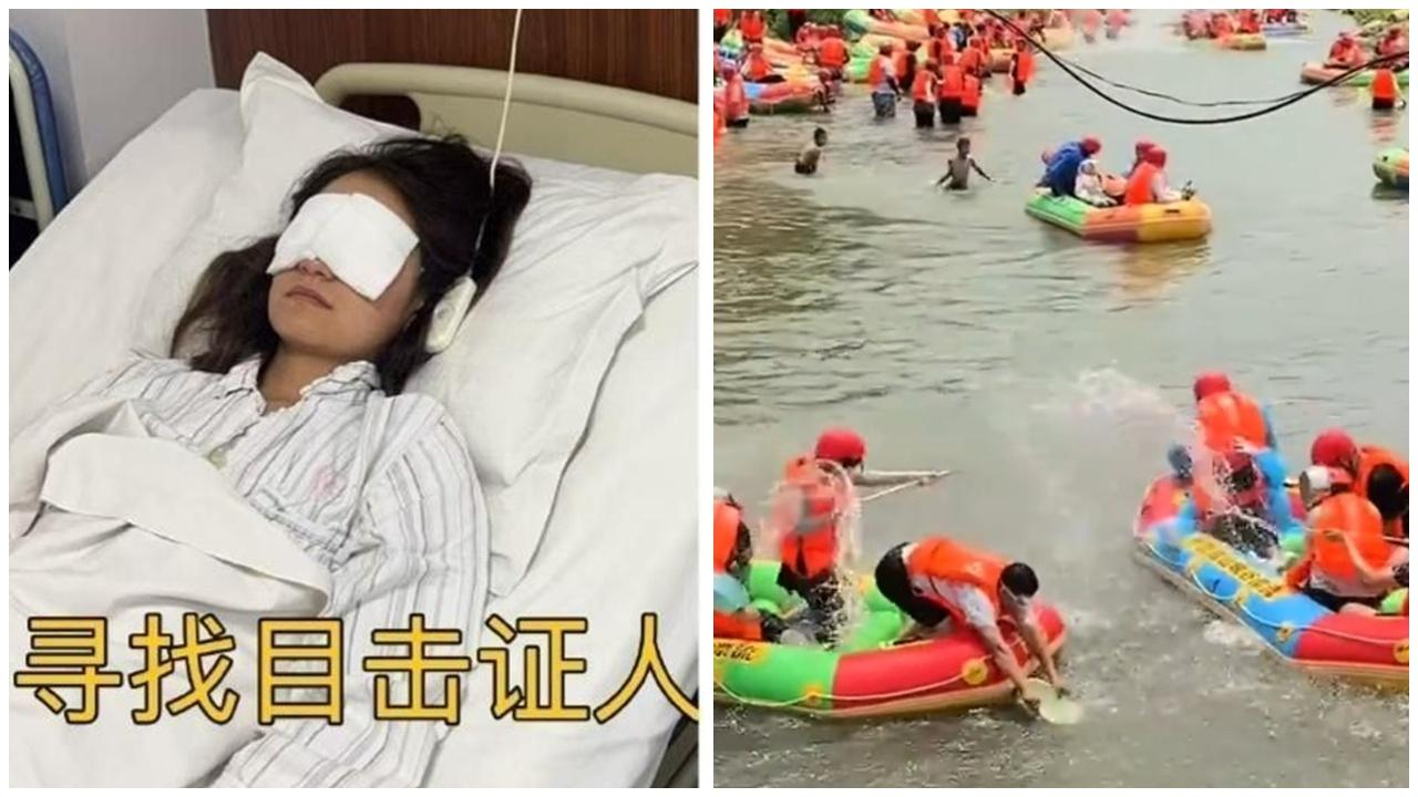 女遊客山東景區玩漂流，慘遭陌生男用高壓水槍射盲眼。(微博)