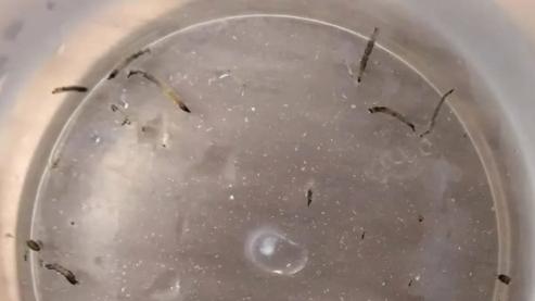 揚州8歲女童口吐活蟲，元兇竟然是「牠」。(微博)