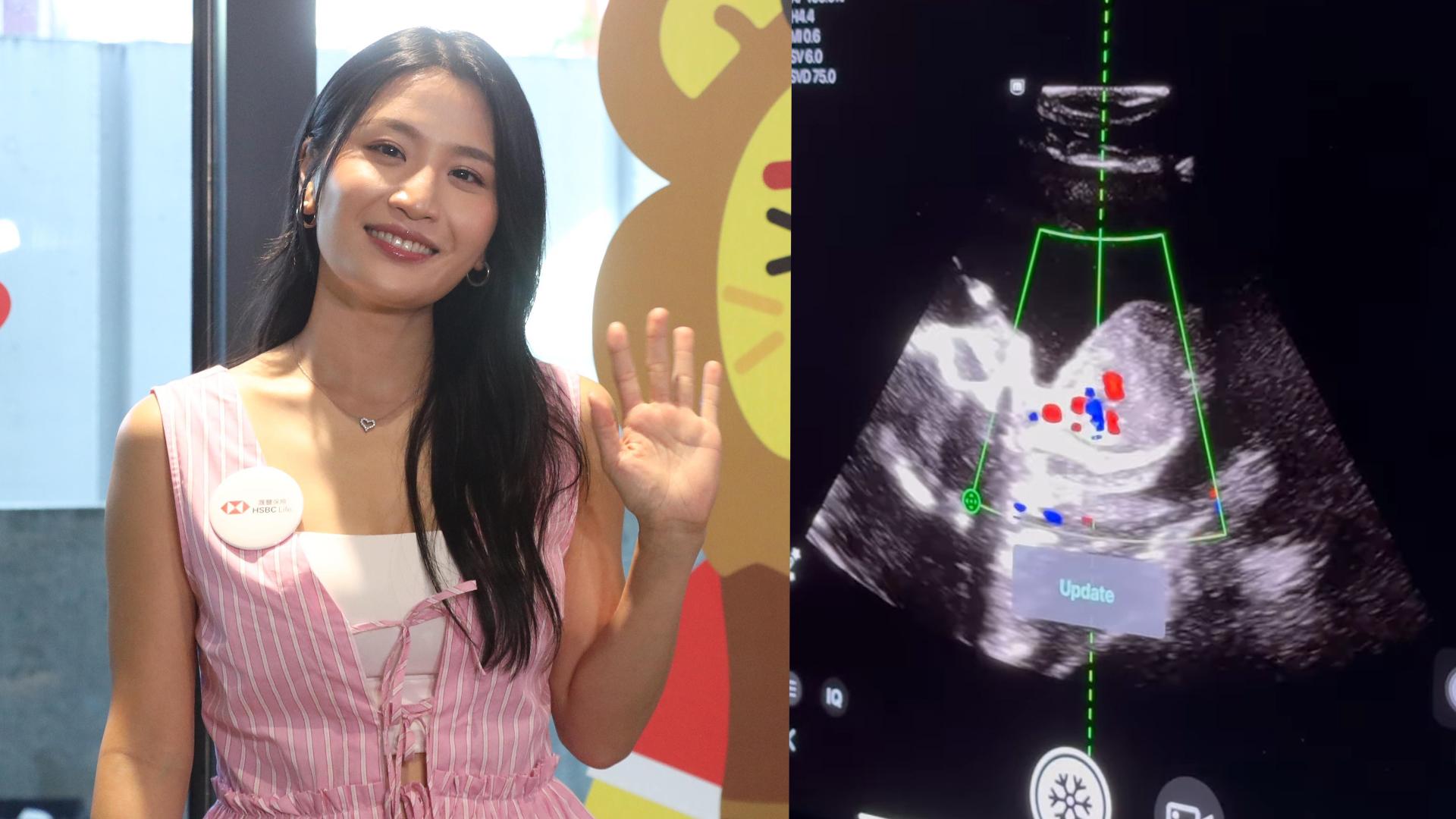 Coffee林芊妤快測結果正常 閉關7日做女王獲老公囝囝貼心照顧