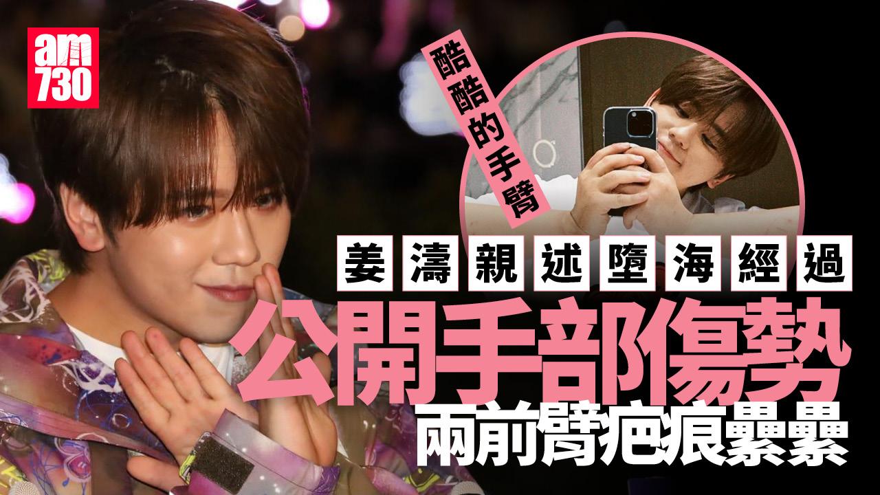 姜濤墮海｜姜濤公開手部傷勢 疤痕纍纍