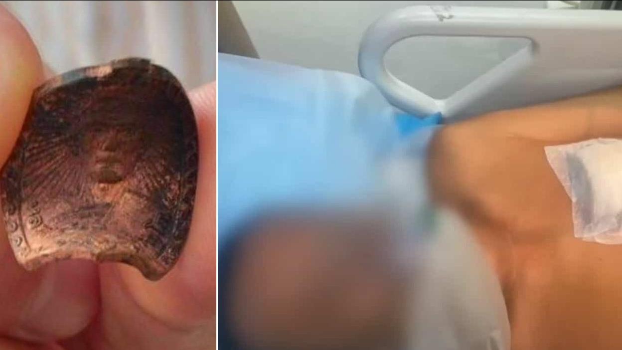 蓬猜被子彈射中左邊胸口，子彈剛好擊中佛牌，導致其變形。(互聯網)