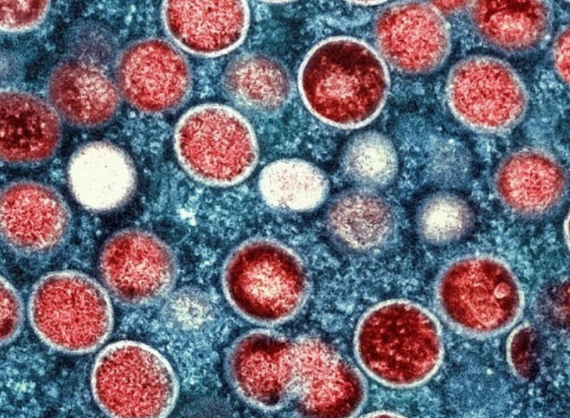 一名58歲男子確診感染猴痘，情況穩定。(資料圖片)