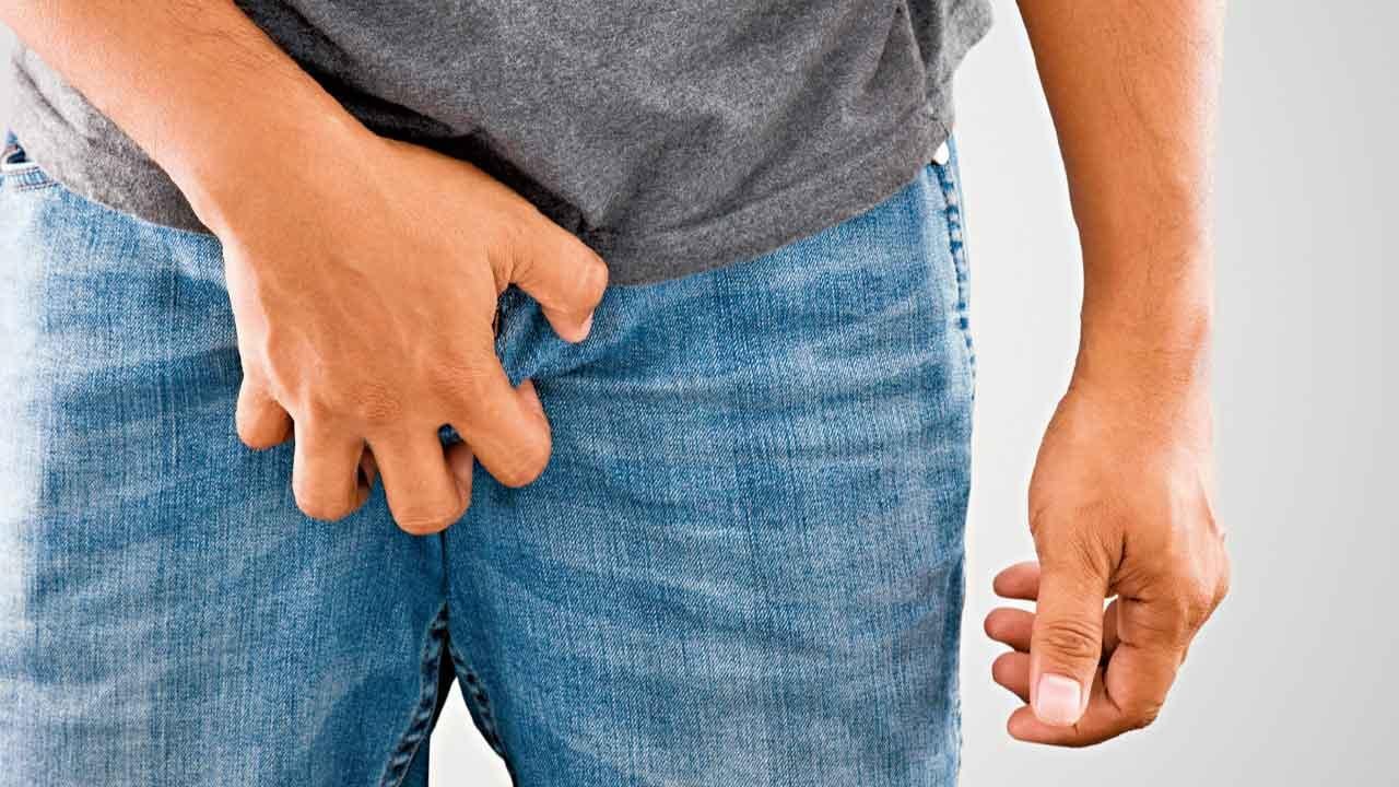 身上帶了一袋蟲 或患精索靜脈曲張