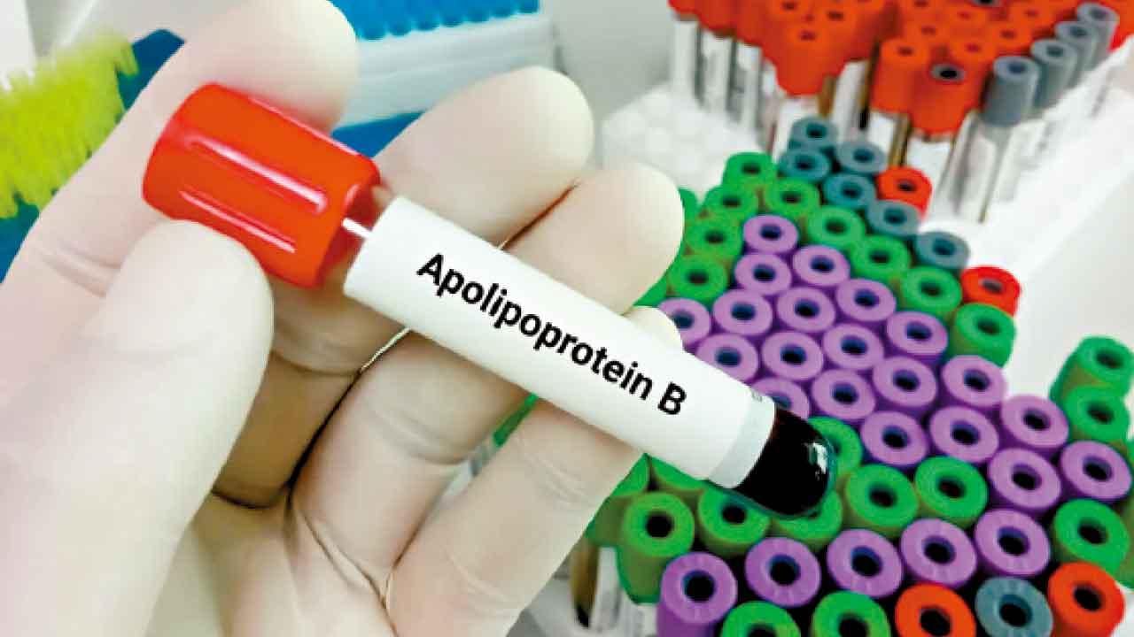 壞膽固醇無害？ 瘦體超反應者的爭議