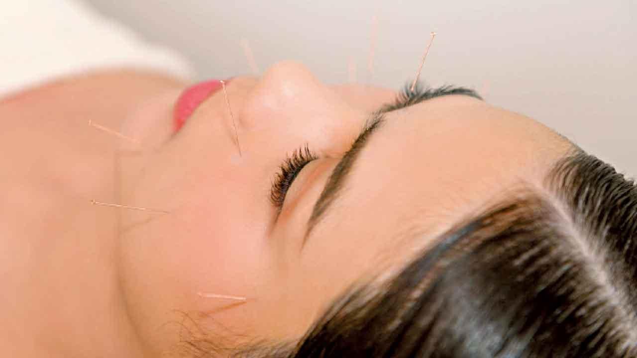 中醫夏季養顏：顏面針灸與食療雙管齊下