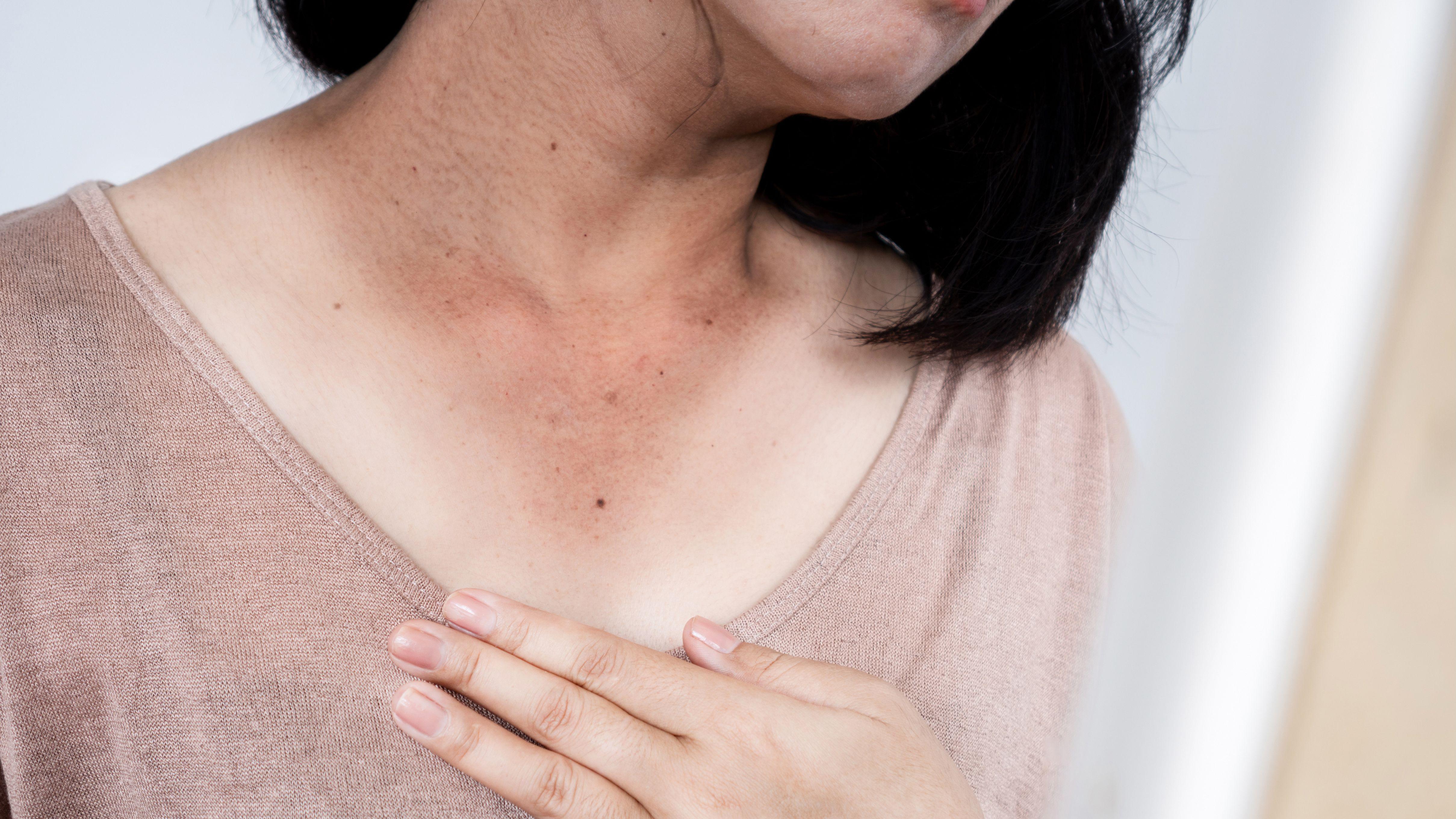 防曬 抗衰老 皮膚癌 癌症 曬黑 出汗 皮膚 紫外線