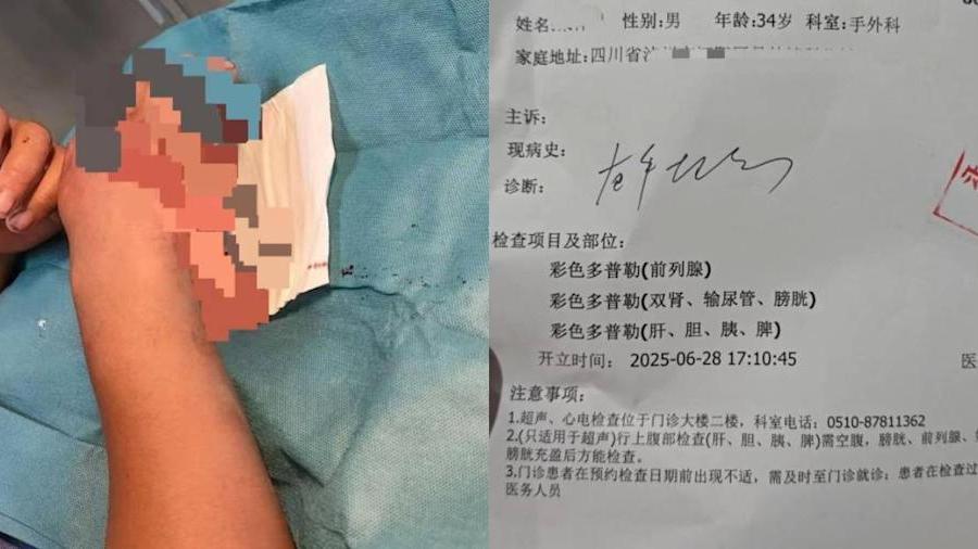 內地男被玻璃割傷手睇醫生　竟被要求檢查前列腺