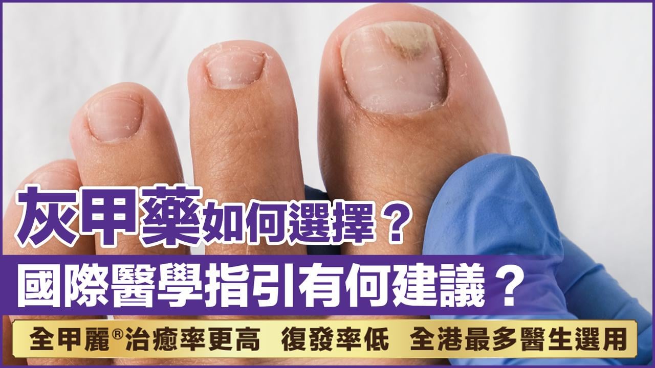 灰甲藥如何選擇 國際醫學指引有何建議？