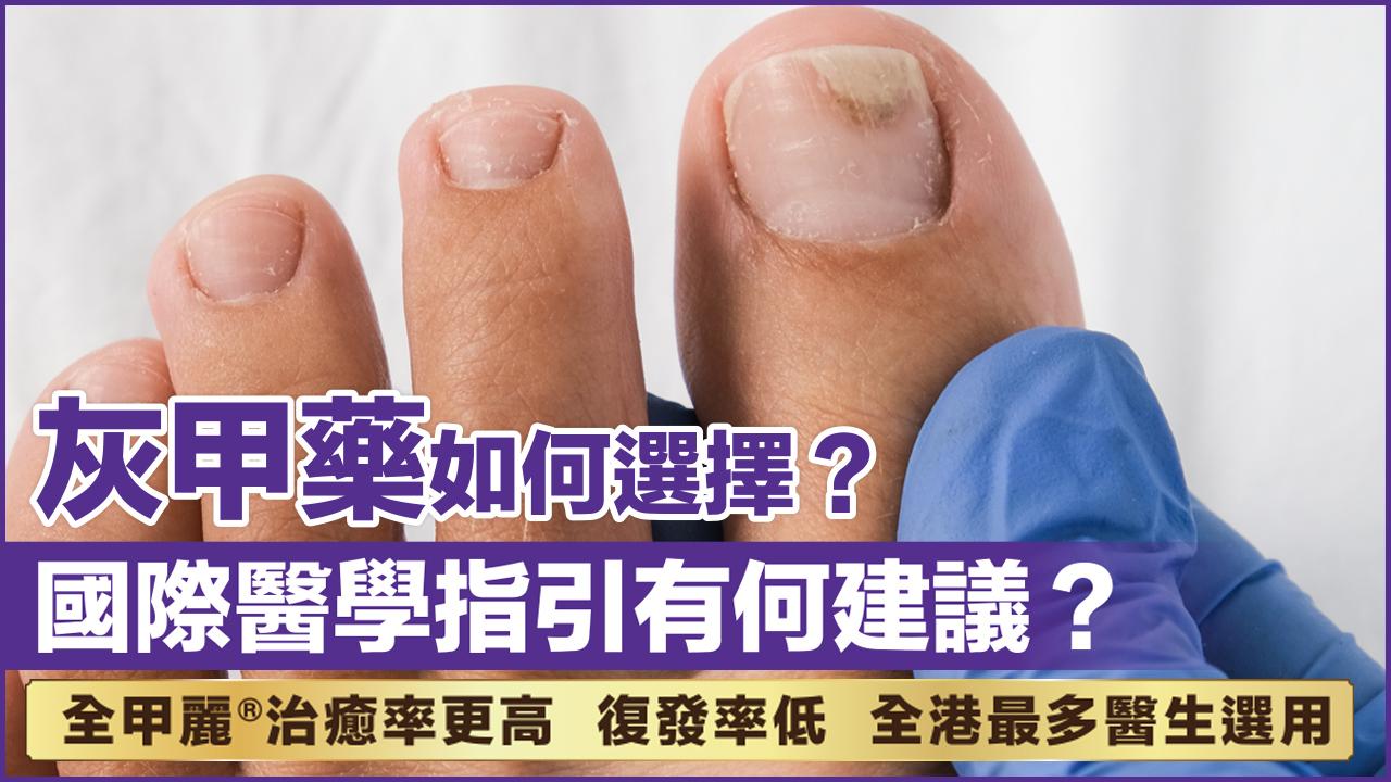 灰甲藥如何選擇 國際醫學指引有何建議？