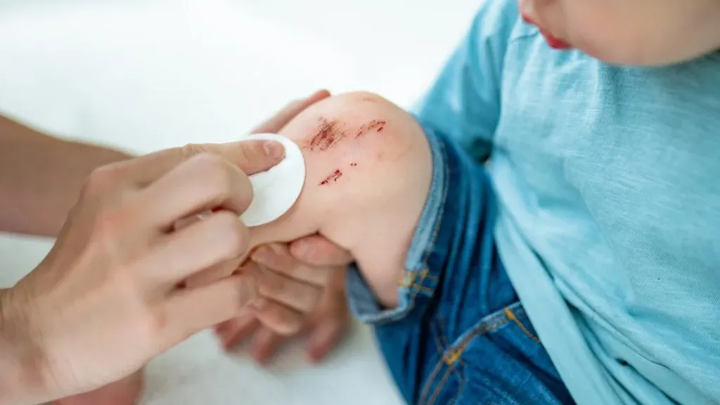 馬偕紀念醫院急診科翁梓華醫生表示，優碘與碘酒最大的差別在「碘酒含有酒精成分，而優碘則沒有」，但不是所有的傷口都應該使用碘酒消毒。