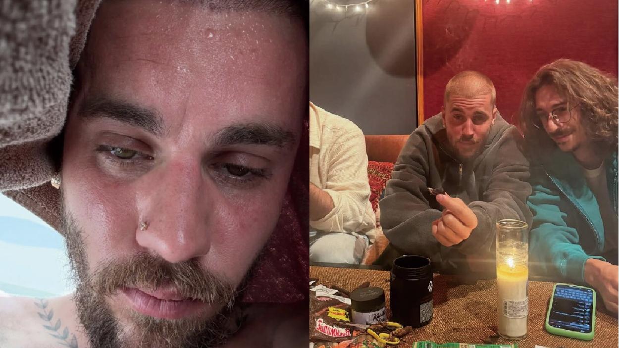 Justin Bieber容貌斷崖式衰老 自拍稱正在戒毒