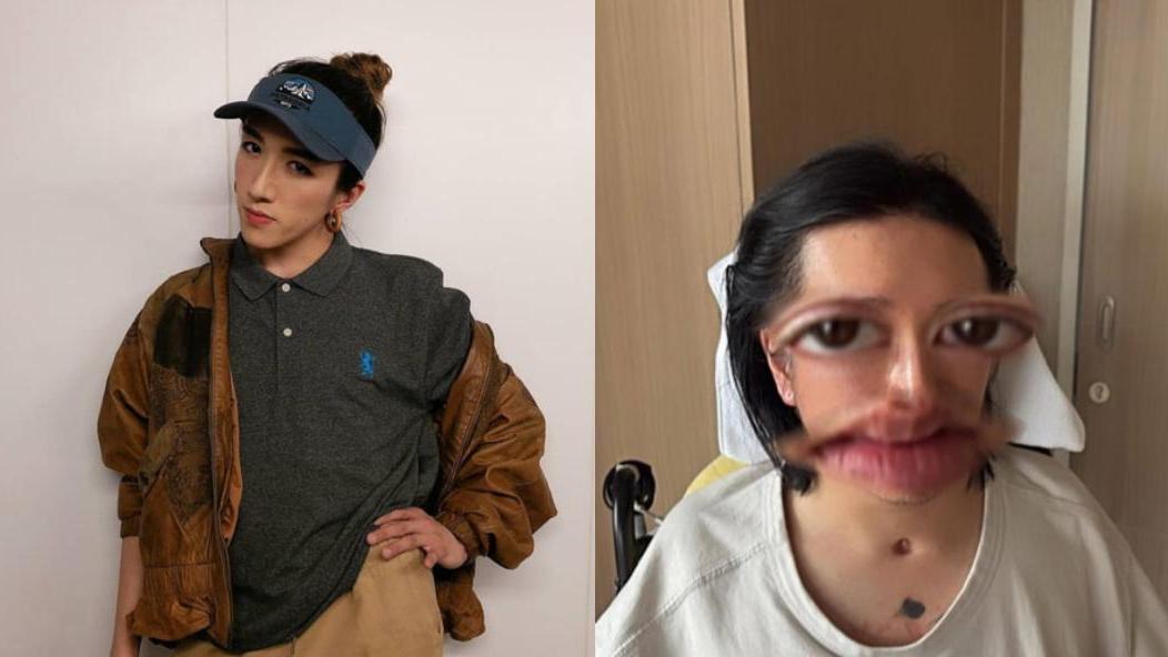 阿Mo李啟言突破醫學傳統挑戰不可能 質疑MIRROR演唱會事故無人承擔責任