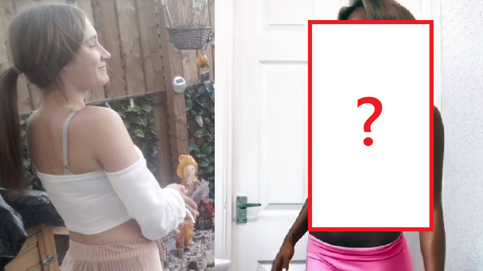 18歲女每周曬燈4次 黑過古天樂如「燒燶薯片」恐生癌仍戒不了