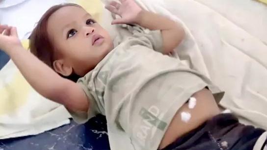 印度比哈爾邦1歲男童戈文達把眼鏡蛇當玩具，險些沒命，經治療後留院觀察。(互聯網)