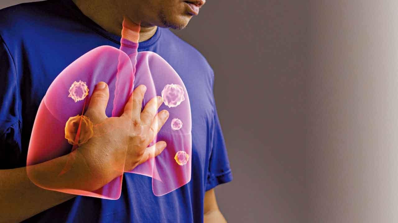 年輕不吸煙 也易患肺腺癌？