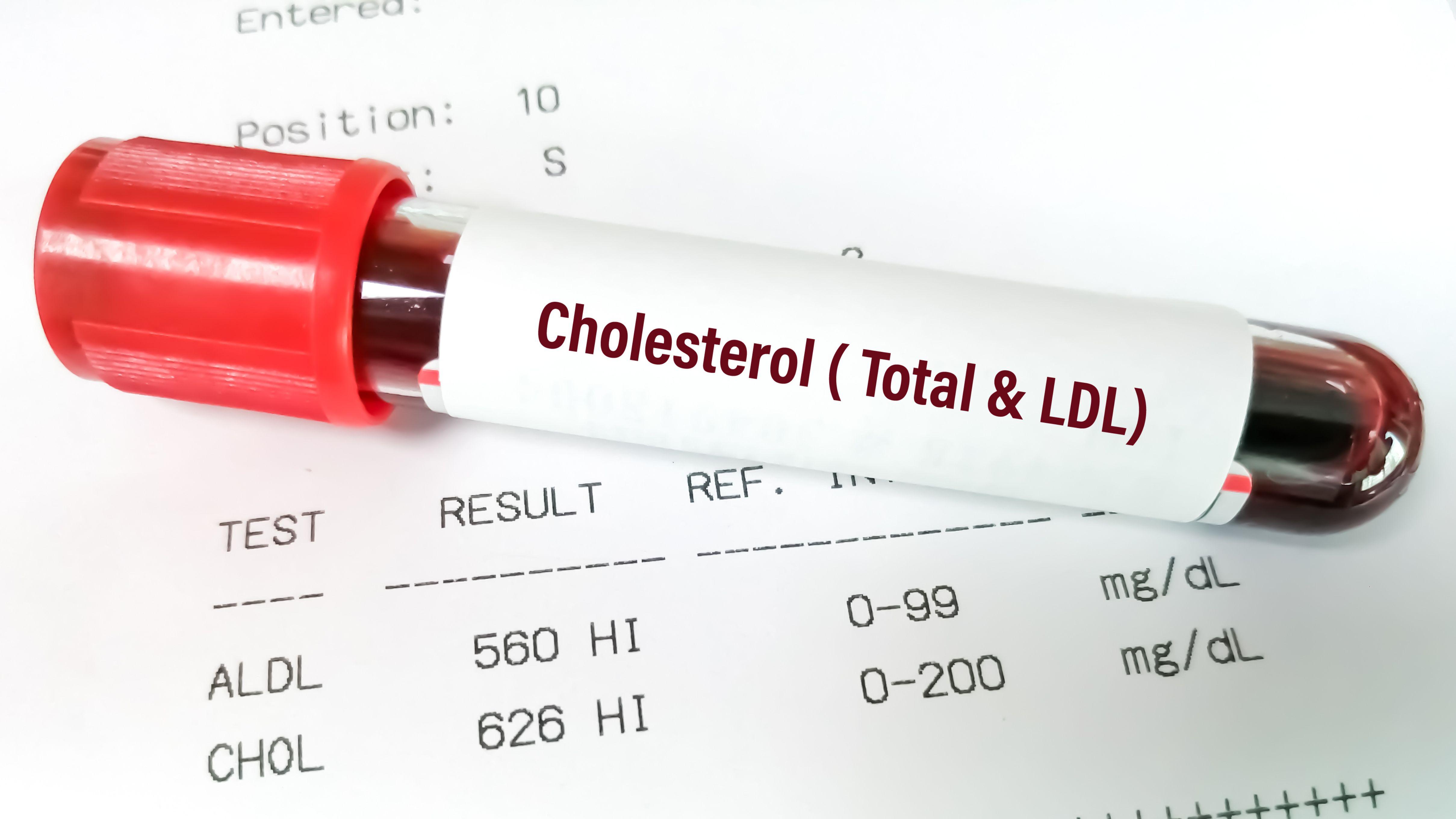 膽固醇 膳物膽固醇 低密度膽固醇 動物性食品 植物性油脂 脂肪 膳食纖維