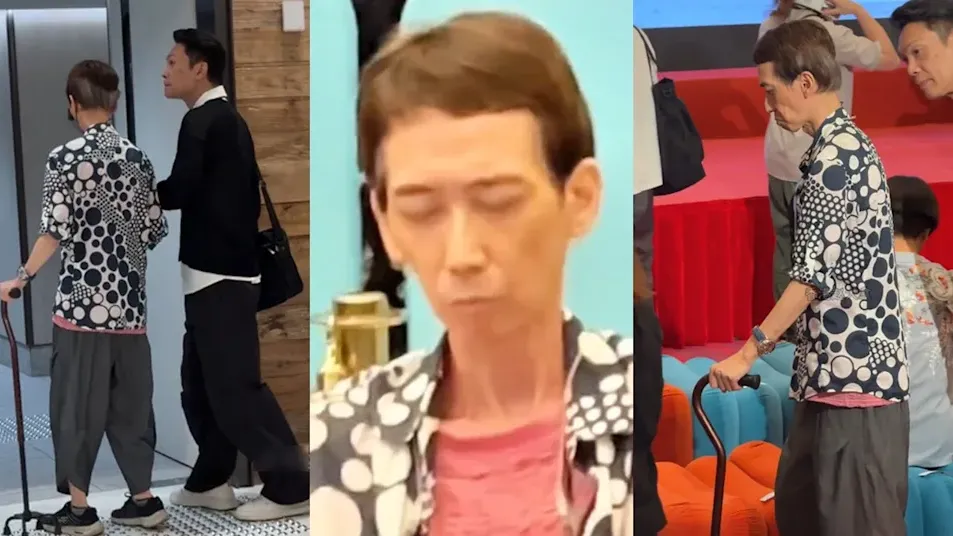 張達明日前出席活動時顯得暴瘦如「紙片人」，並且需撐拐杖助行及要友人攙扶。（小紅書影片截圖）