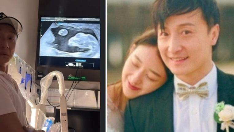 方力申陪老婆產檢 睇超聲波大讚BB脊骨好靚