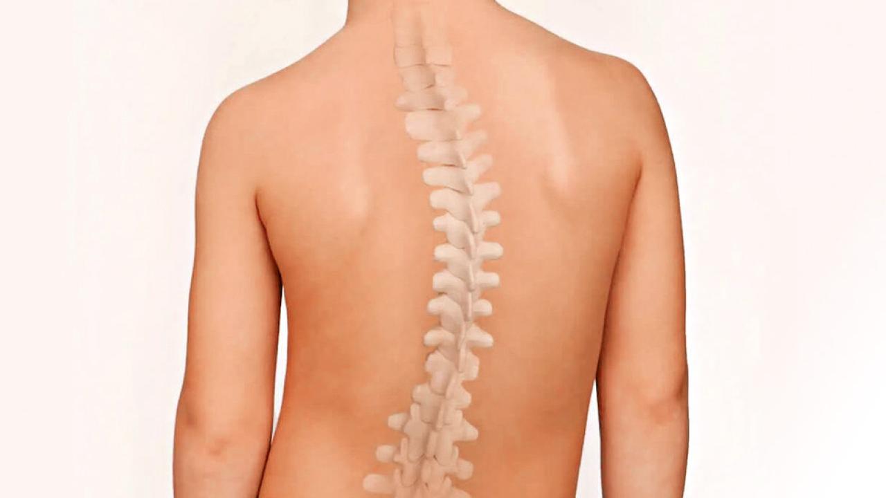 把握兒童脊柱側彎治療黃金期