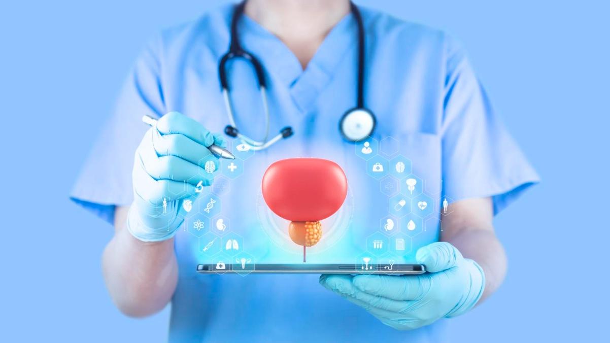 前列腺癌是全球男性第二常見的癌症Z