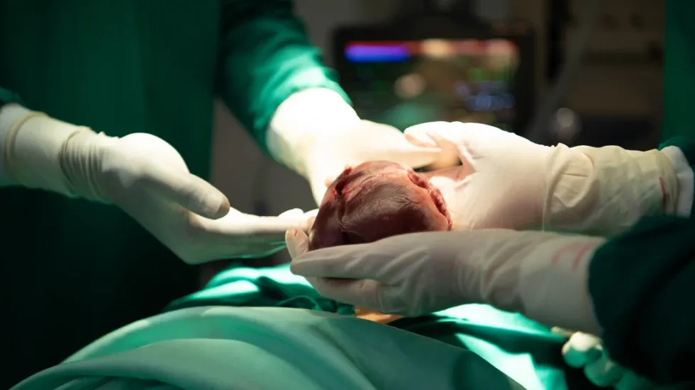 目前新一代左心室輔助器採用全磁懸浮摩打設計，能長期穩定輸送血液，並顯著降低血栓形成、機械磨損與感染風險。