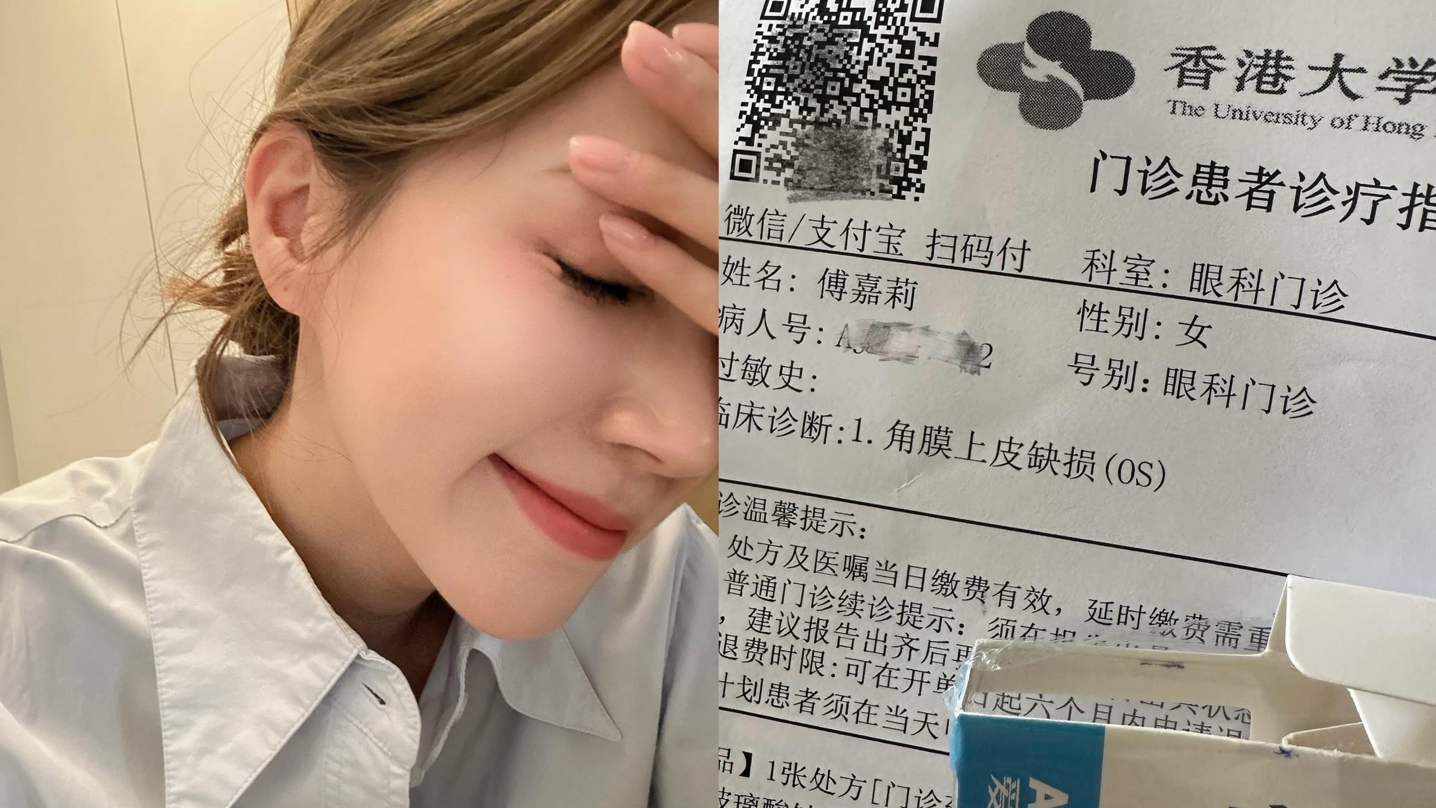 傅嘉莉內地拍劇受傷 換衫割走3mm眼角膜