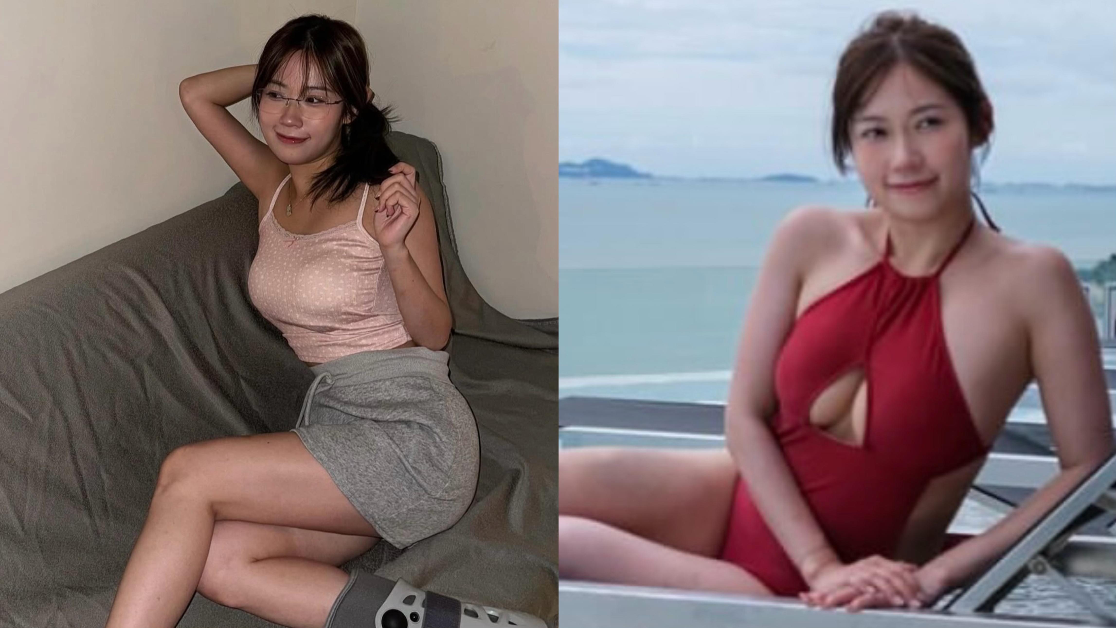 波波黃婧靈周身病痛 視網膜突然脫落過馬路都睇不清