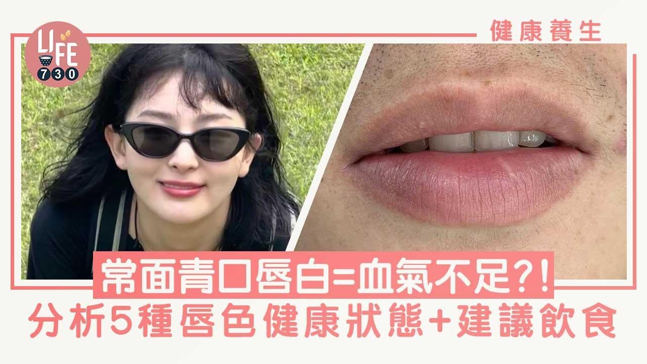 唇色健康｜常面青口唇白=血氣不足？分析5種狀態+建議飲食