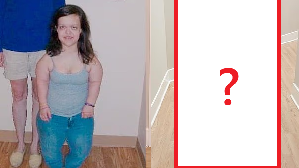 31歲女痛苦「斷骨增高」13吋 究竟有無效？現況曝光令人吃驚