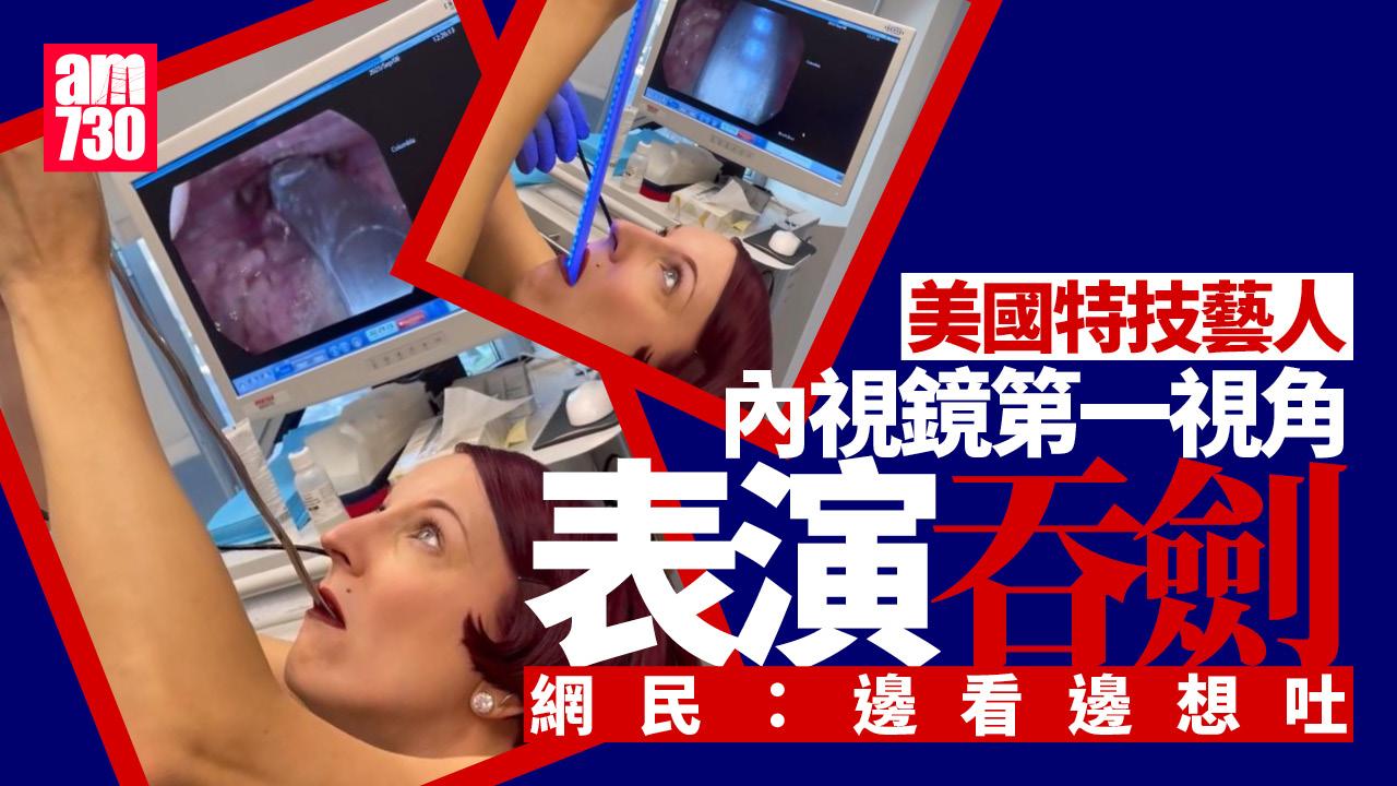 內窺鏡第一視角睇吞劍　46厘米長蛇形劍發光劍插食道(有片)