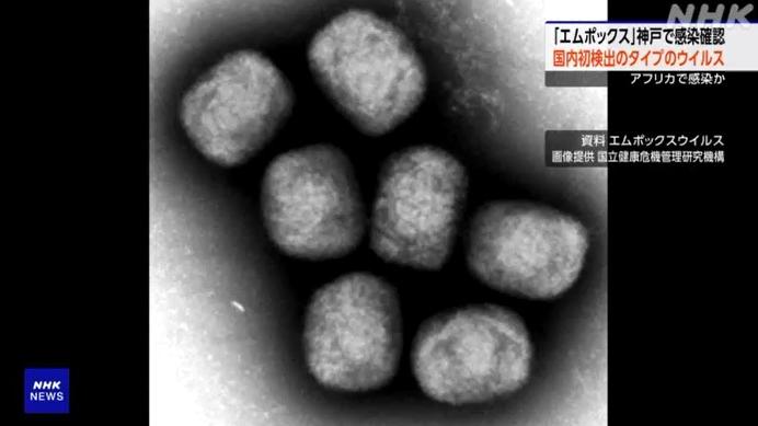 電子顯微鏡下的猴痘病毒。(互聯網)