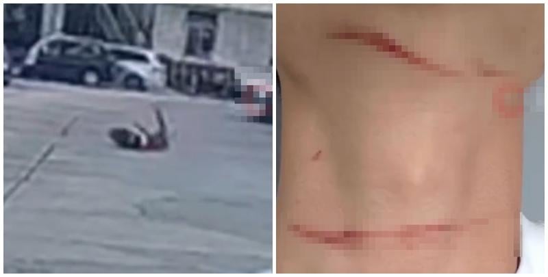 一名深圳男子日前在洪湖公園附近騎電動車時，突被風箏線勒喉割傷摔倒受傷，風箏線疑由公園飄來。(影片截圖)