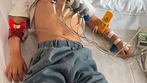 兒童吃下問題三文治後嚴重不適，須留院治療。(互聯網)