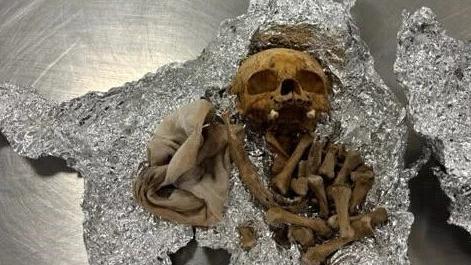 疑似人類頭骨及多根骨頭用錫紙包住，藏在行李內。(互聯網)