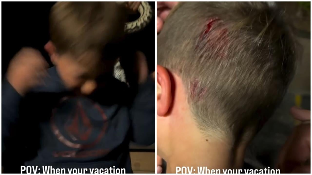 男童動物園體驗蟒蛇掛頸，慘被咬頭浴血。(IG)