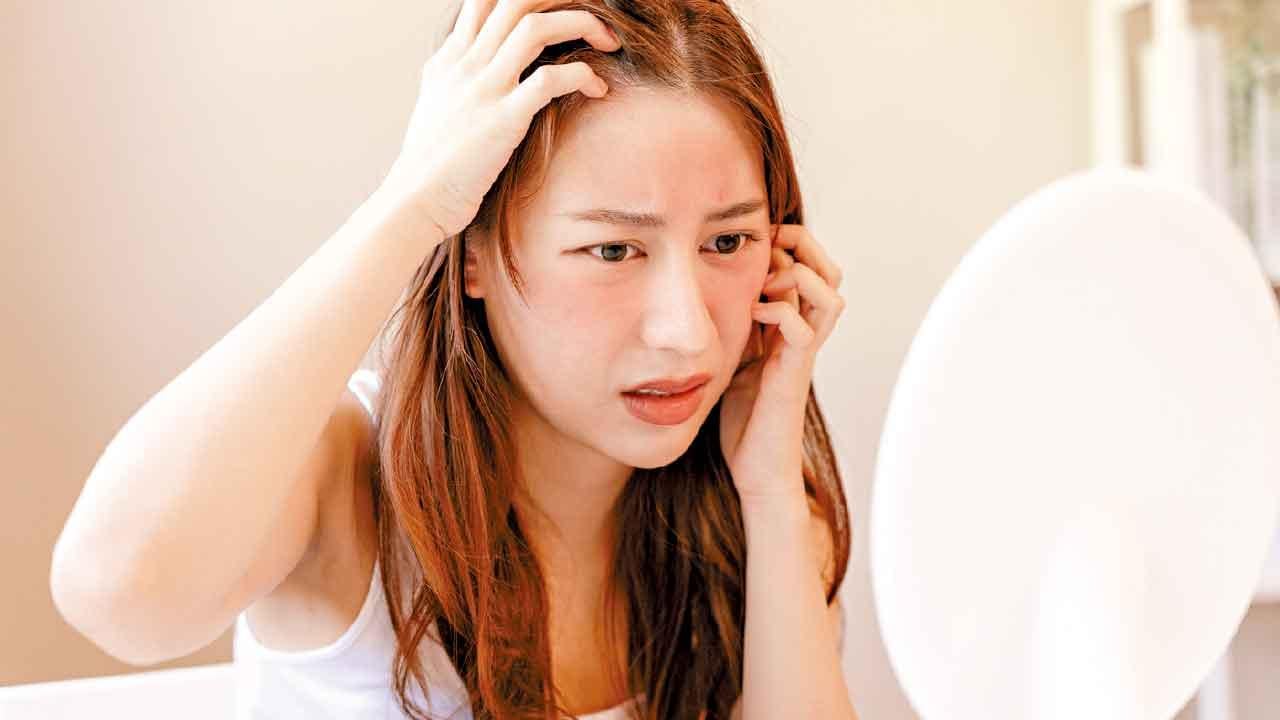 秋冬面紅紅 可能係皮膚病？