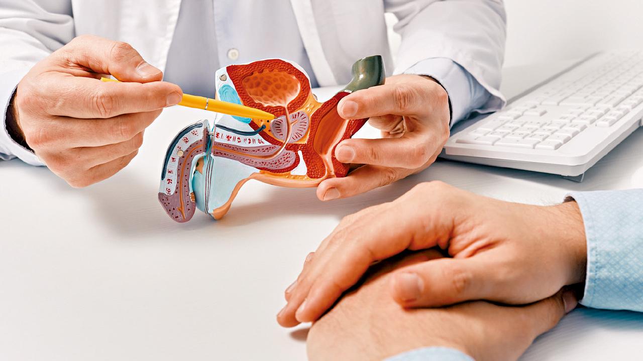 立體定位電療技術 治療晚期前列腺癌 3年100%存活