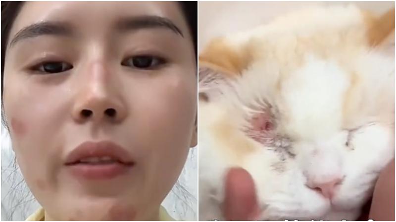內地一名女子誤信賣家稱貓癬不用治療，導致自己也遭到感染。（圖／翻攝網路）
