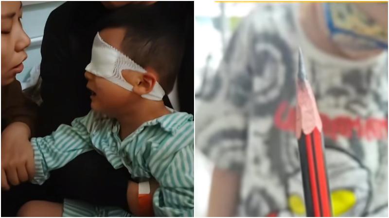 5歲童遭同學戳傷眼球，幼師「塗豬油」致感染失明。（圖／翻攝微博）