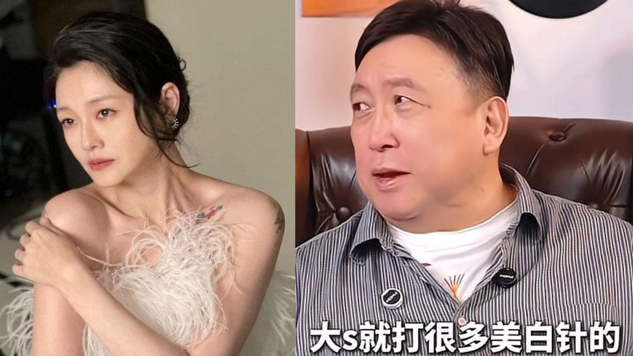 王晶指大S皮膚黑靠打美白針 性格似關之琳咁溫柔